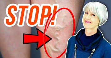 Riduci gambe gonfie e le vene varicose con pochi semplici esercizi!